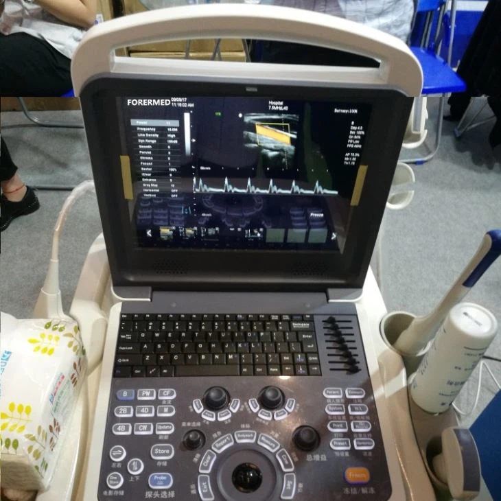 4D Notebook Color Ultrasound System Scanner 4D Notebook Color Ultrasound System Scanner