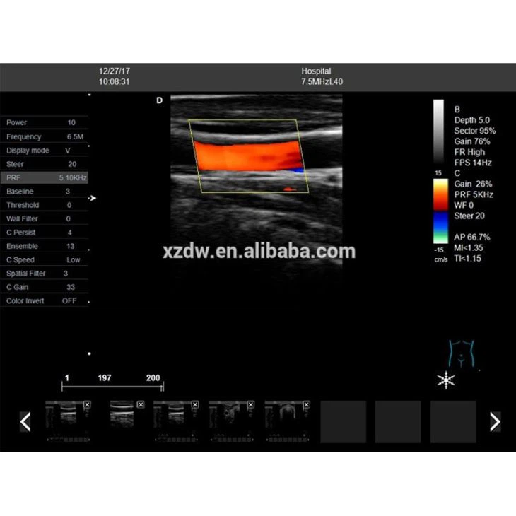 High Quality 4D Ultrasound Transducer