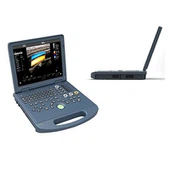Laptop rangli Doppler ultratovush apparati