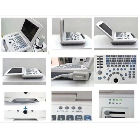 Black And White Laptop Ultrasound Scanner